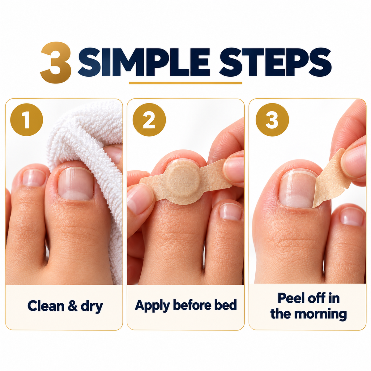FUNGEX Fungal Nail Repair Patches | لصقات فونجيكس لإصلاح الأظافر المصابة بالفطريات